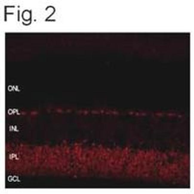 SHANK1 Antibody in Immunohistochemistry (IHC)