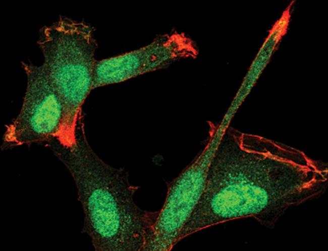 SMAD3 Antibody in Immunocytochemistry (ICC/IF)