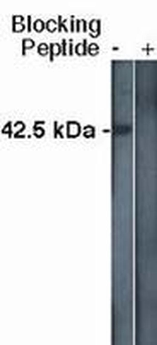 SPHK1 Antibody in Western Blot (WB)