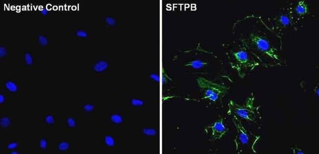 SFTPB Antibody in Immunocytochemistry (ICC/IF)