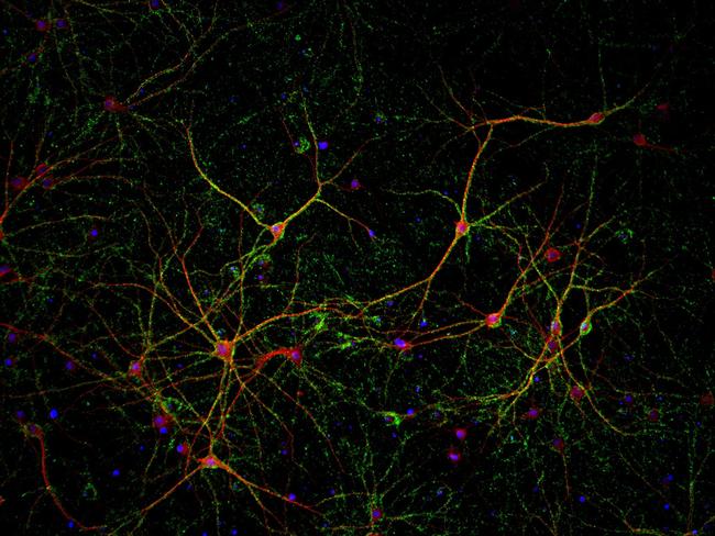 Synapsin 1 Antibody in Immunocytochemistry (ICC/IF)