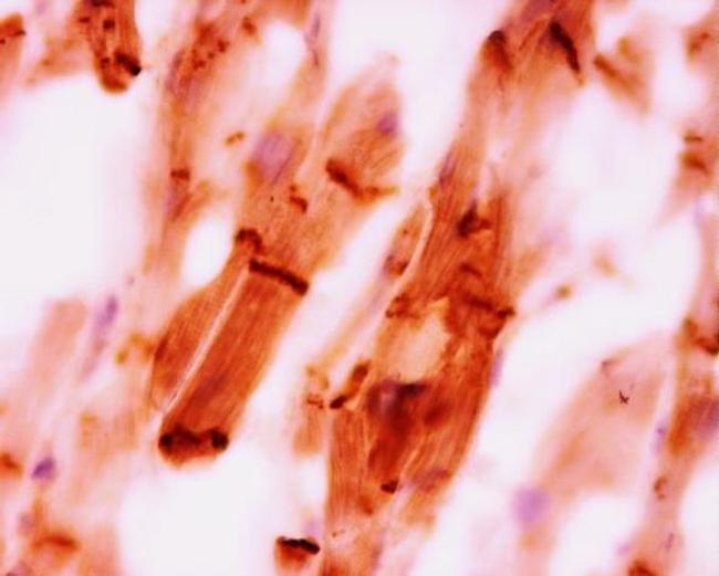 CTNNA3 Antibody in Immunohistochemistry (Paraffin) (IHC (P))