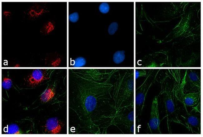 Rabbit IgG (H+L) Cross-Adsorbed Secondary Antibody in Immunocytochemistry (ICC/IF)