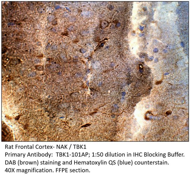 NAK Antibody in Immunohistochemistry (IHC)