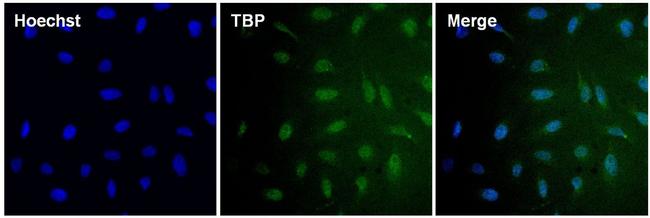 TBP Antibody in Immunocytochemistry (ICC/IF)