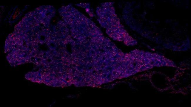 TBX3 Antibody in Immunohistochemistry (Paraffin) (IHC (P))