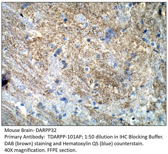 DARPP32 Antibody in Immunohistochemistry (IHC)