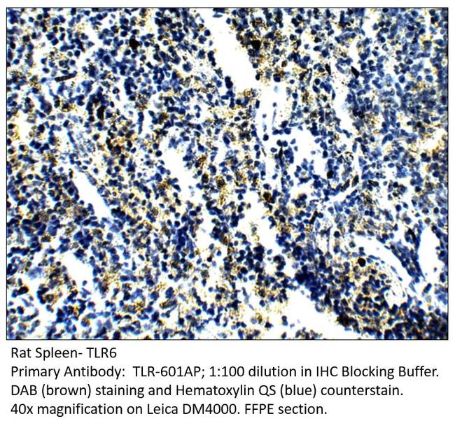 TLR6 Antibody in Immunohistochemistry (IHC)