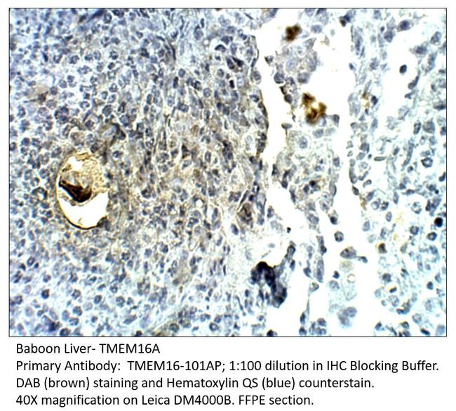 TMEM16A Antibody in Immunohistochemistry (Paraffin) (IHC (P))