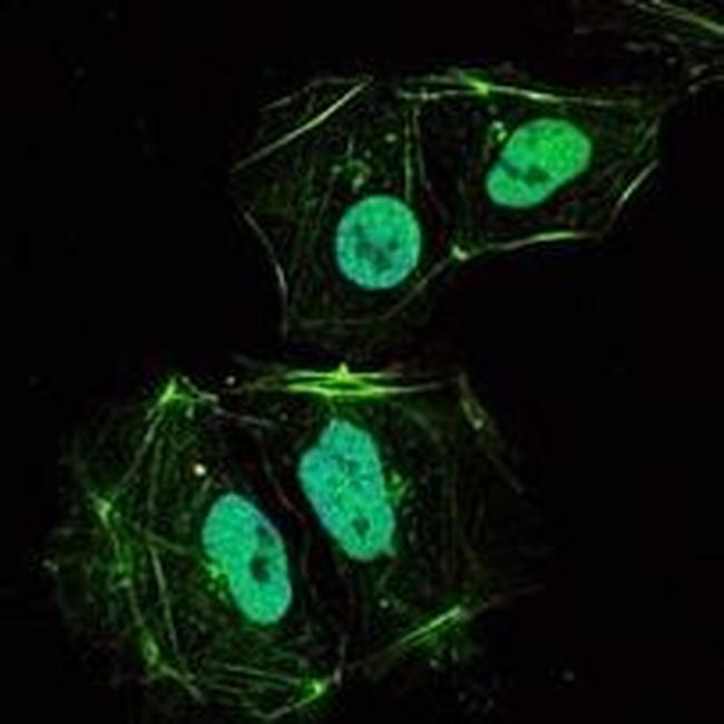 TNFRSF11B Antibody in Immunocytochemistry (ICC/IF)