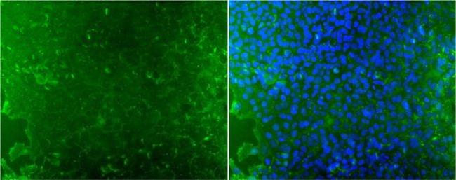 TRA-1-60 Antibody in Immunocytochemistry (ICC/IF)