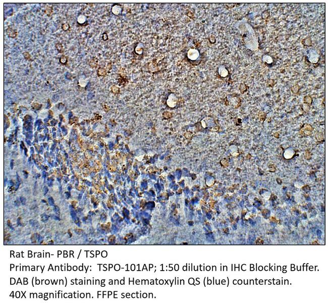 PBR Antibody in Immunohistochemistry (IHC)