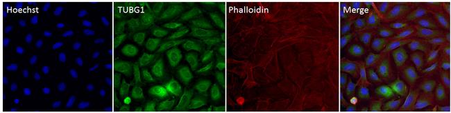 gamma Tubulin Antibody in Immunocytochemistry (ICC/IF)