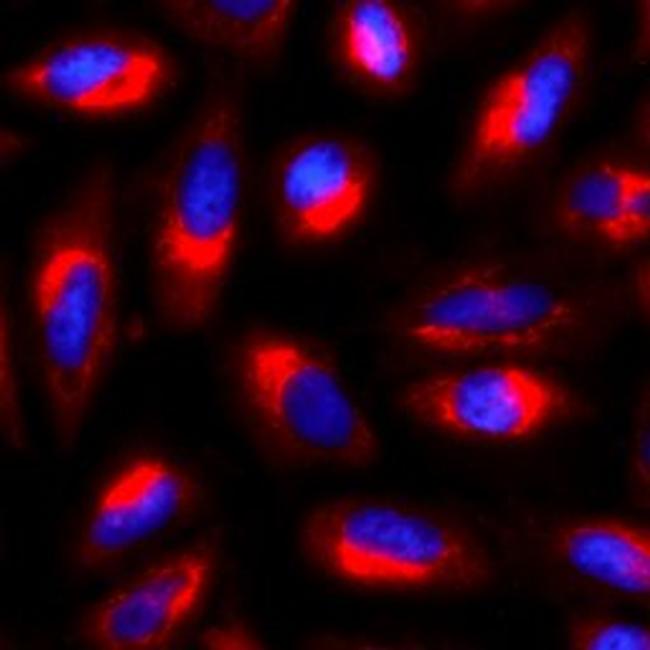 gamma Tubulin Antibody in Immunocytochemistry (ICC/IF)