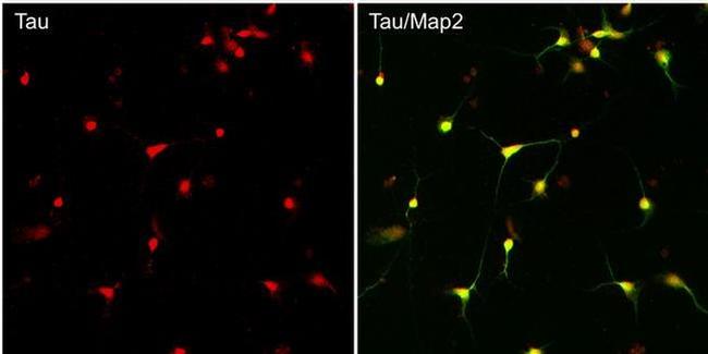 Tau Antibody in Immunocytochemistry (ICC/IF)