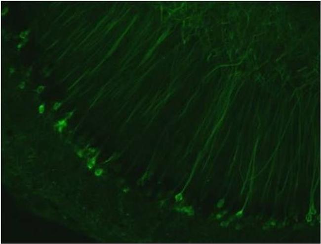 Tau Antibody in Immunohistochemistry - Free Floating (IHC (Free))