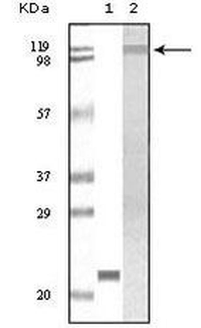 TYK2 Antibody in Western Blot (WB)