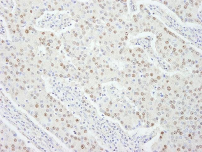 UBE1 Antibody in Immunohistochemistry (IHC)