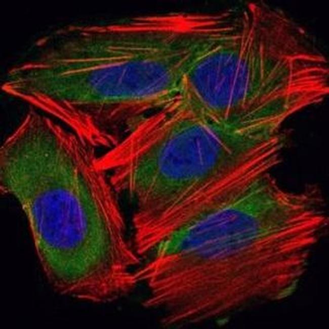 UBC9 Antibody in Immunocytochemistry (ICC/IF)