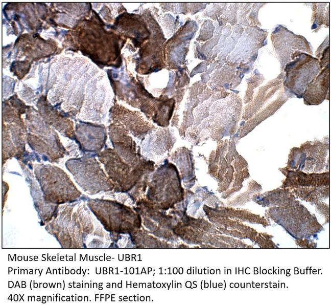 UBR1 Antibody in Immunohistochemistry (IHC)