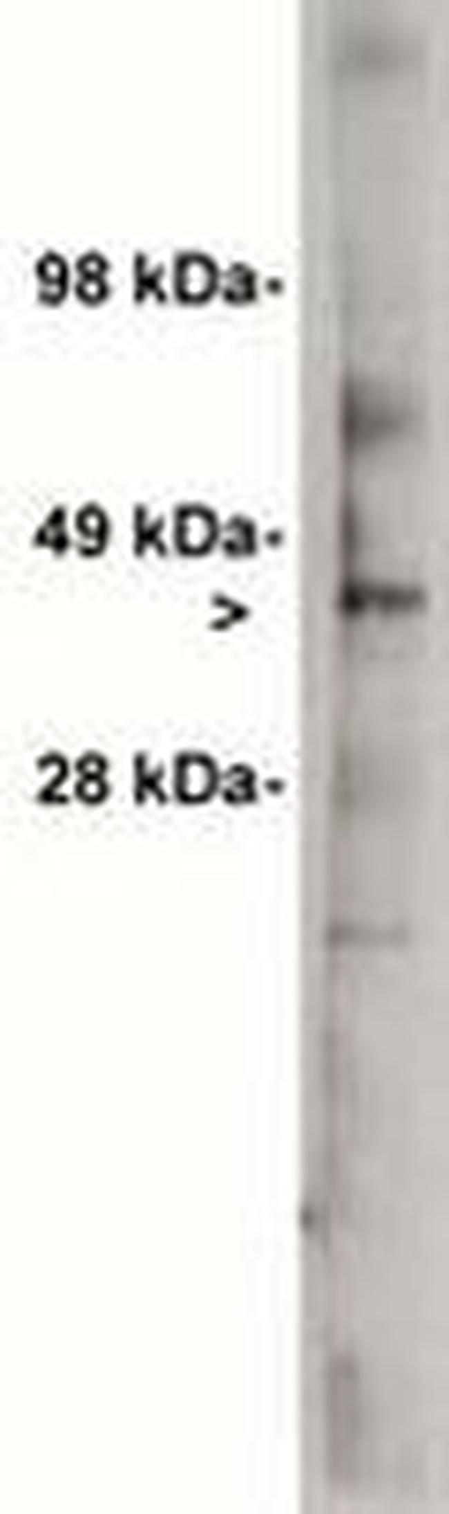 UGCG Antibody in Western Blot (WB)