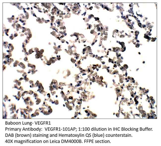 VEGFR1 Antibody in Immunohistochemistry (IHC)