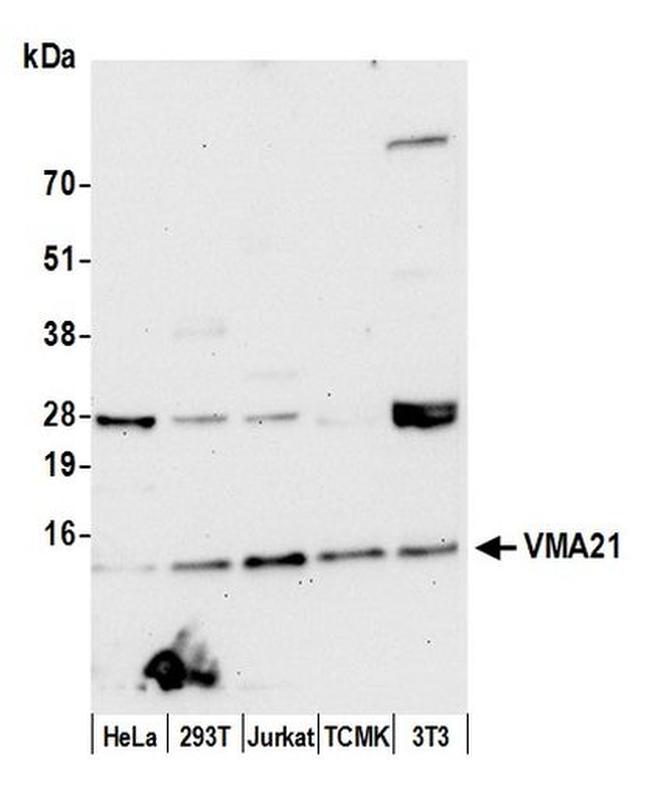 VMA21 Antibody in Western Blot (WB)