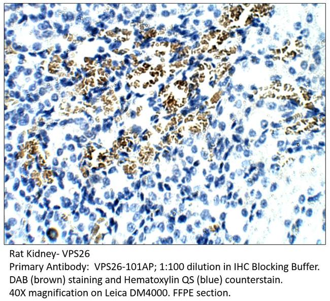 VPS26 Antibody in Immunohistochemistry (IHC)