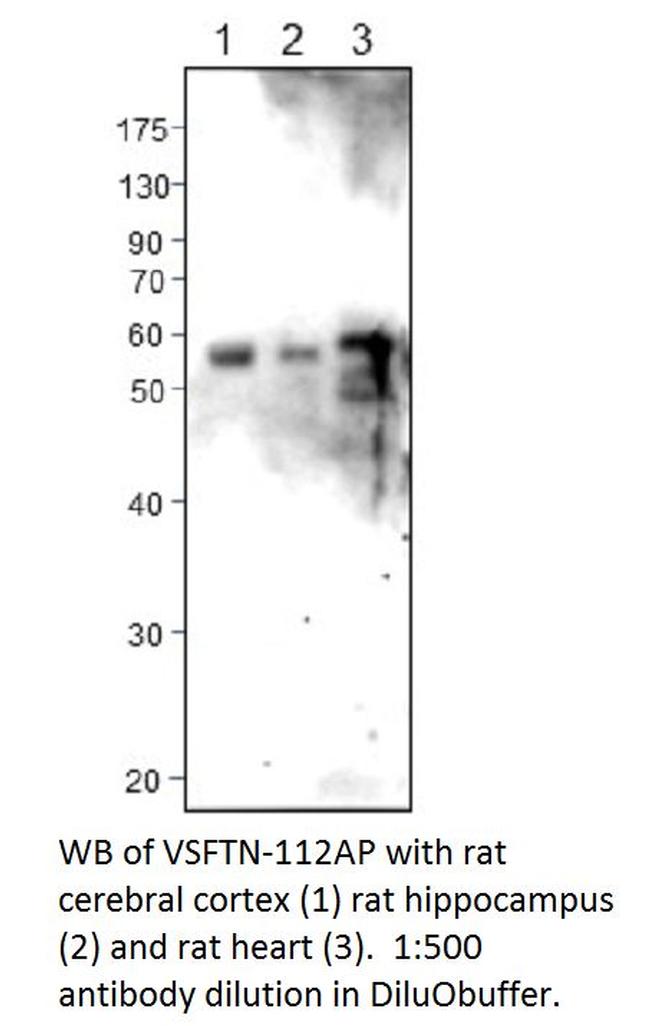 Visfatin Antibody in Western Blot (WB)