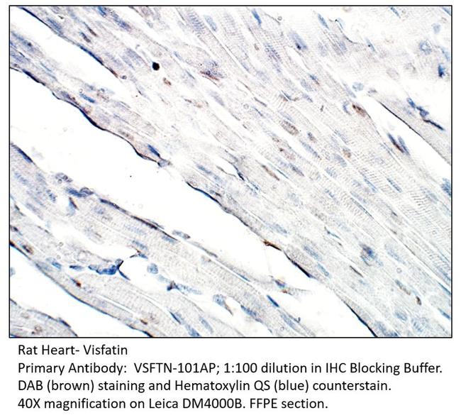 Visfatin Antibody in Immunohistochemistry (Paraffin) (IHC (P))