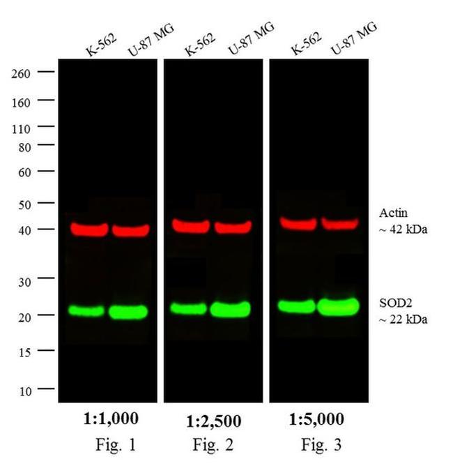 Mouse IgG (H+L) Secondary Antibody in Western Blot (WB)