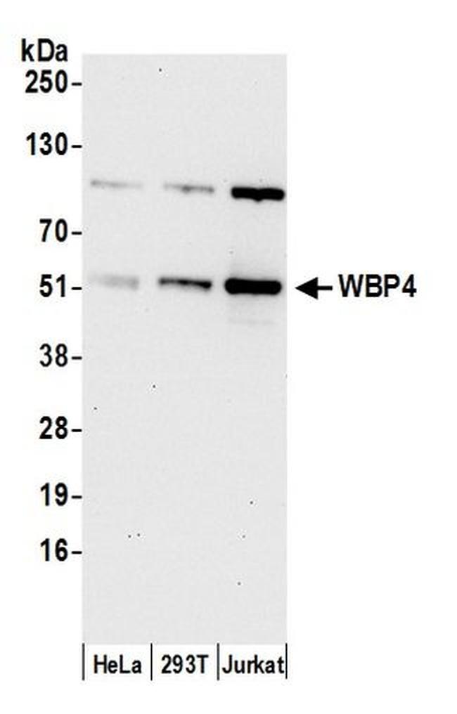 WBP4 Antibody in Western Blot (WB)