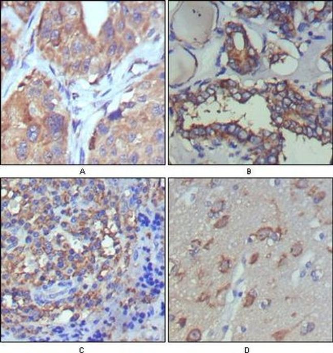 WNT5A Antibody in Immunohistochemistry (Paraffin) (IHC (P))