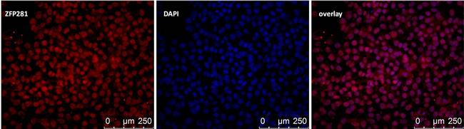 ZNF281 Antibody in Immunocytochemistry (ICC/IF)