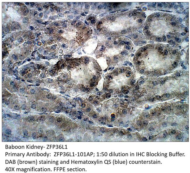 ZFP36L1 Antibody in Immunohistochemistry (IHC)