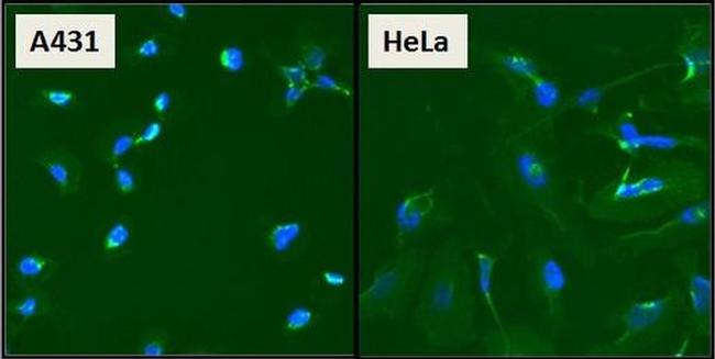 beta Catenin Antibody in Immunocytochemistry (ICC/IF)