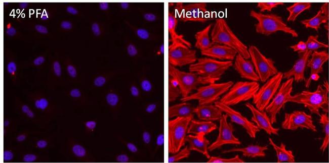 beta Actin Antibody in Immunocytochemistry (ICC/IF)