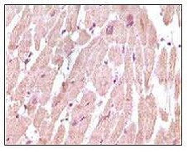 Cardiac Troponin I Antibody in Immunohistochemistry (Paraffin) (IHC (P))