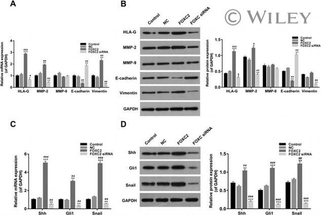 SHH Antibody in Western Blot (WB)