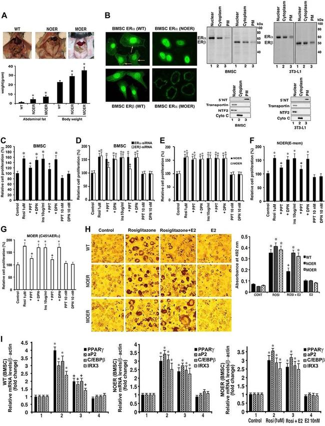 Estrogen Receptor beta Antibody in Western Blot, Immunocytochemistry (WB, ICC/IF)