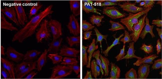 mTOR Antibody in Immunocytochemistry (ICC/IF)