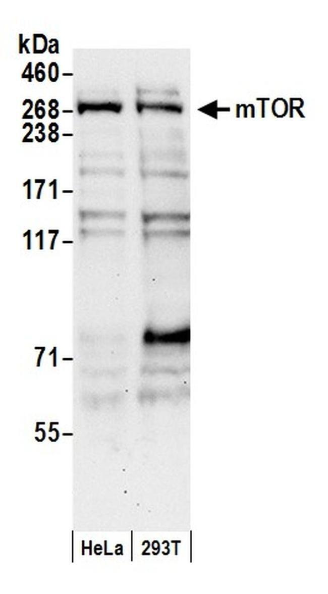 mTOR Antibody in Western Blot (WB)