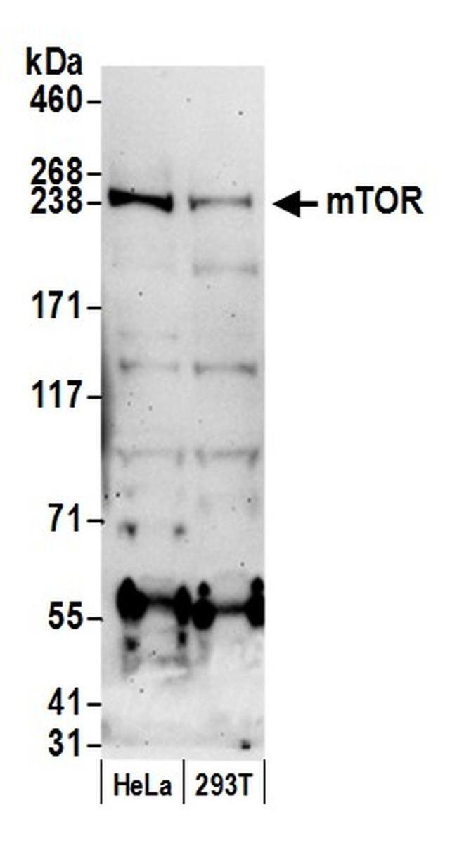 mTOR Antibody in Western Blot (WB)