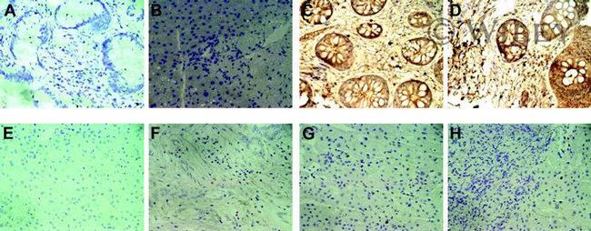 MICA/B Antibody in Immunohistochemistry (IHC)