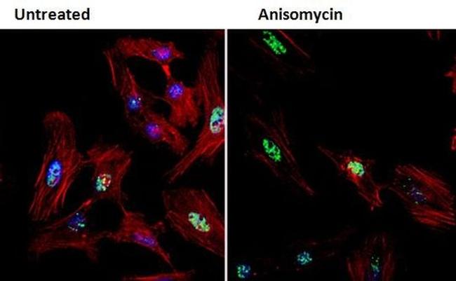 Phospho-CHK2 (Thr68) Antibody in Immunocytochemistry (ICC/IF)