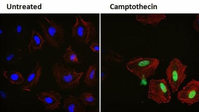 p21 Antibody in Immunocytochemistry (ICC/IF)