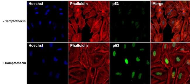 p53 Antibody in Immunocytochemistry (ICC/IF)