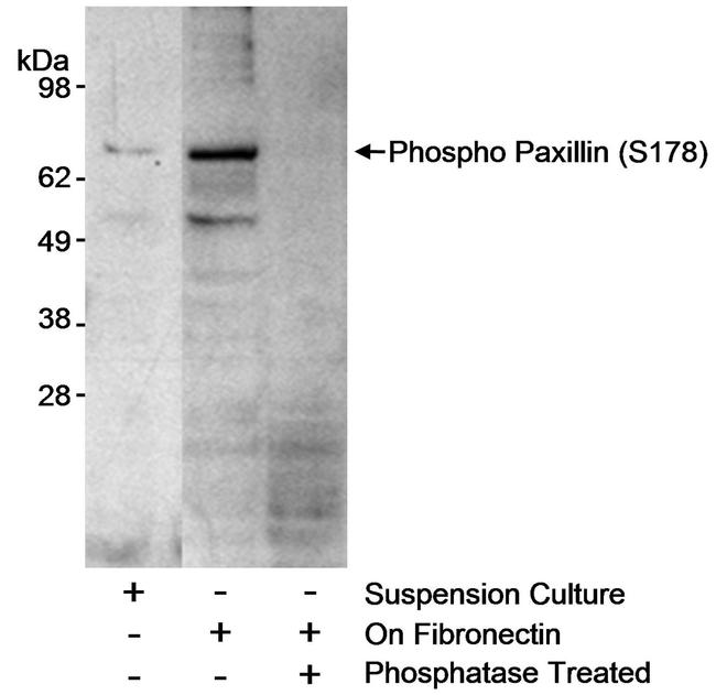 Phospho-Paxillin (Ser178) Antibody in Western Blot (WB)