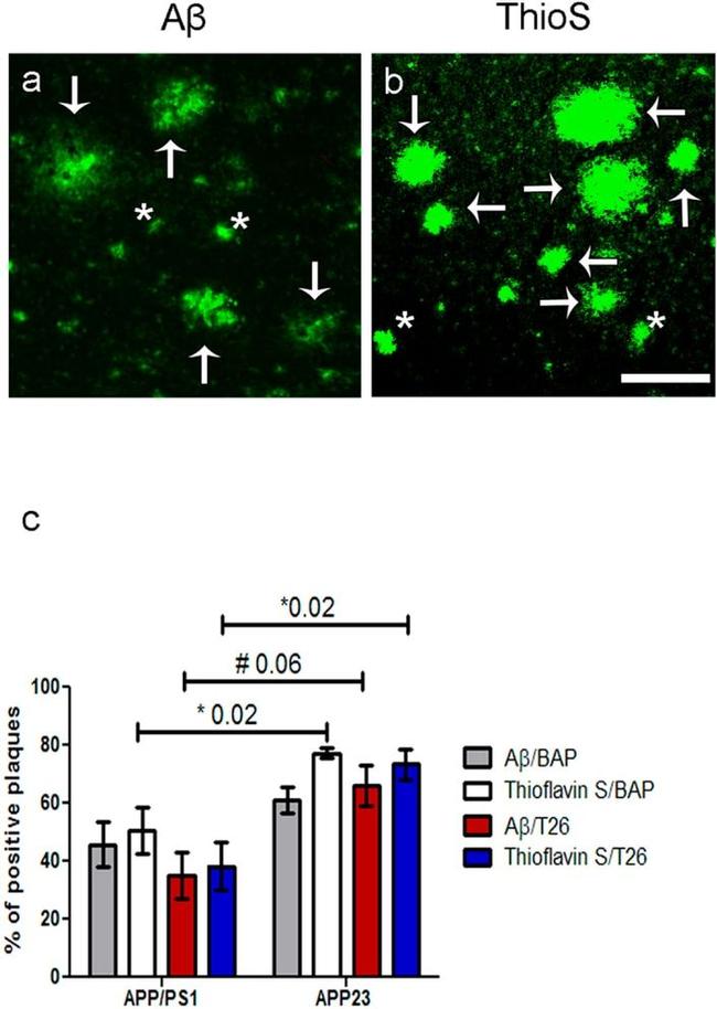 beta Amyloid Antibody in Immunocytochemistry (ICC/IF)