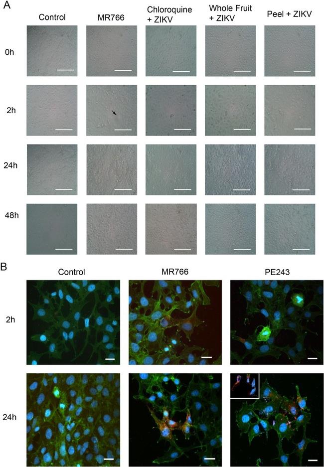 Zika Virus NS1 Antibody in Immunocytochemistry (ICC/IF)